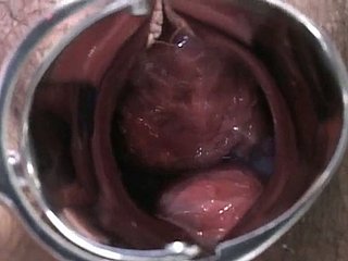 Senhora grávida japonês é examinado e suga lollicock wind up médico
